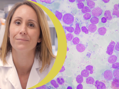 Proyecto Biola Javierre leucemia linfoblástica aguda